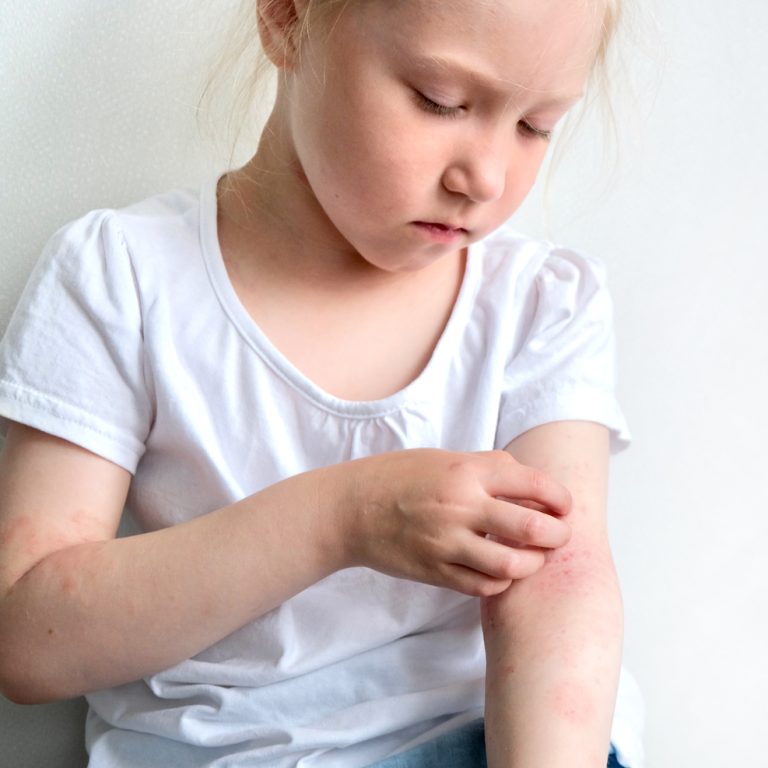 παιδιατρική-δερματολογία-2